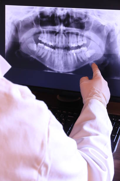 Best Emergency Dentist for Knocked-Out Tooth in Taylor, AL